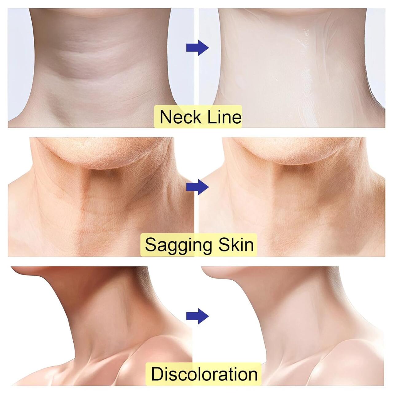 Crema Antienvejecimiento Para el Cuello y Escote (Compra 1 y llévate 3)